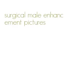 surgical male enhancement pictures